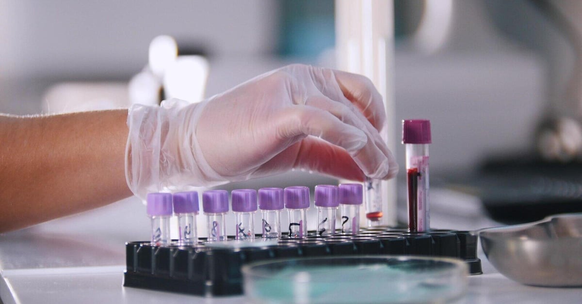 Lab Tests: What They Are, Costs, and How to Get Tested Today ...
