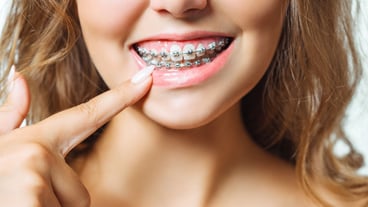 Close-up portrait of young cheerful readhead woman at orthodontist