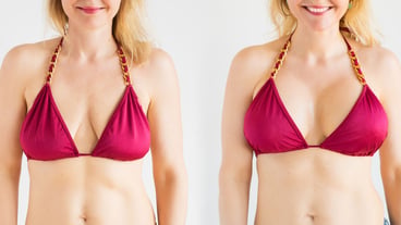 The Ultimate Guide to Understanding Boob Job Before and After Nude