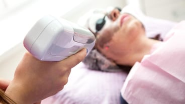 A woman lying couch is undergoing a carbon facial peeling procedure