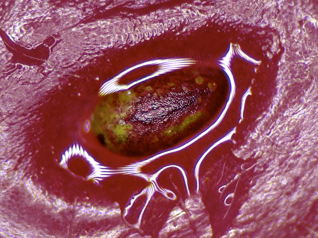 The Interfered Microscopy Plot #56