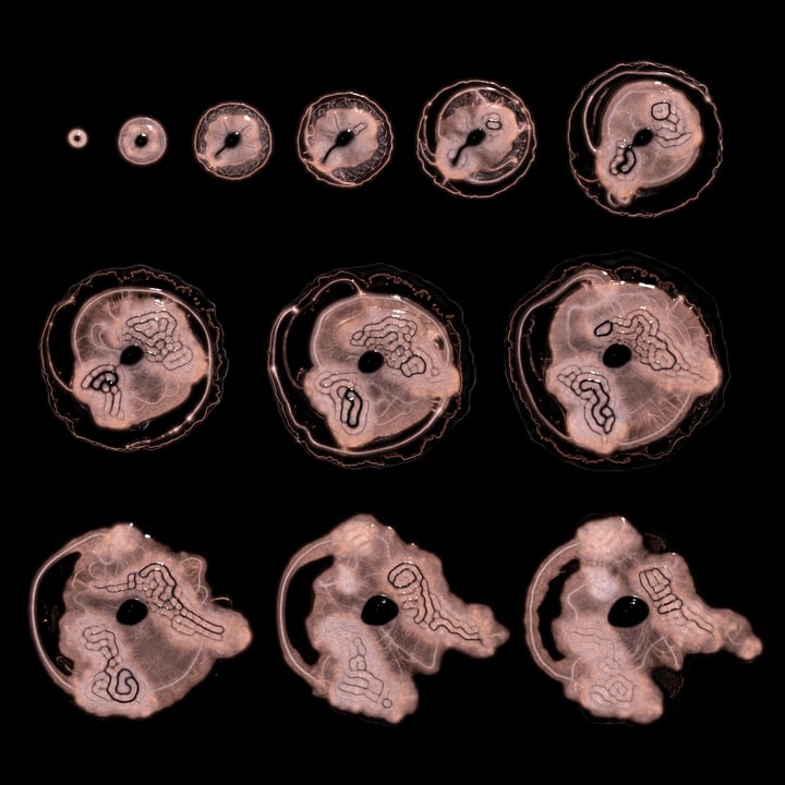 Embryogenesis #28
