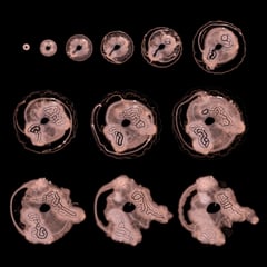 Embryogenesis thumbnail
