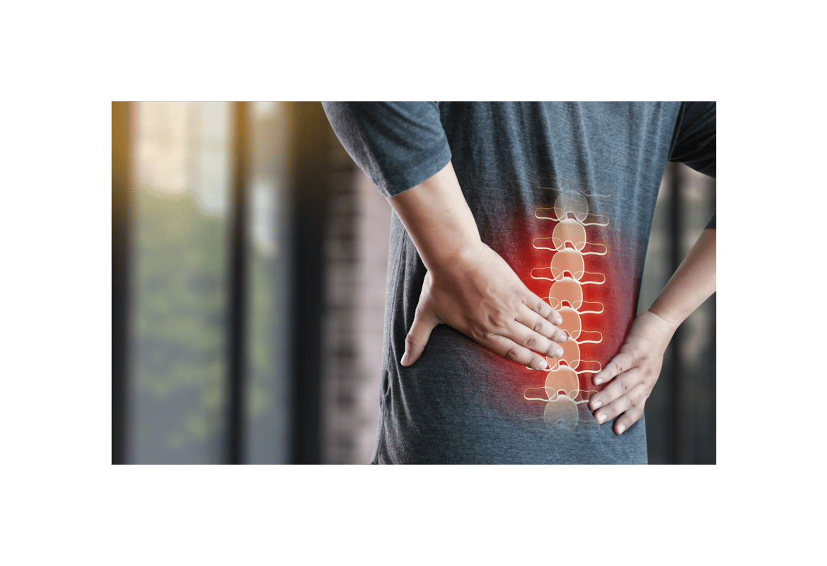 What Type of Mattress Is Best for Scoliosis: Expert Recommendations for Spinal Support and Pain Relief