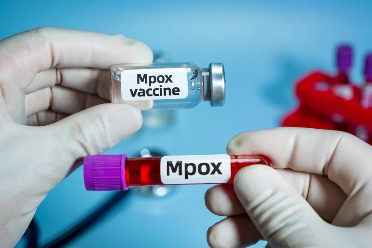mpox-71e756455ed482