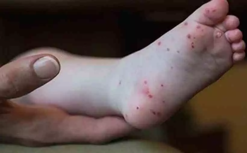 gripe-tomate-5-d9d42a7b65