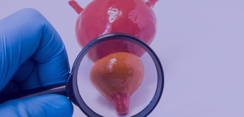 inflamacao-cancer-de-prostata-780x375