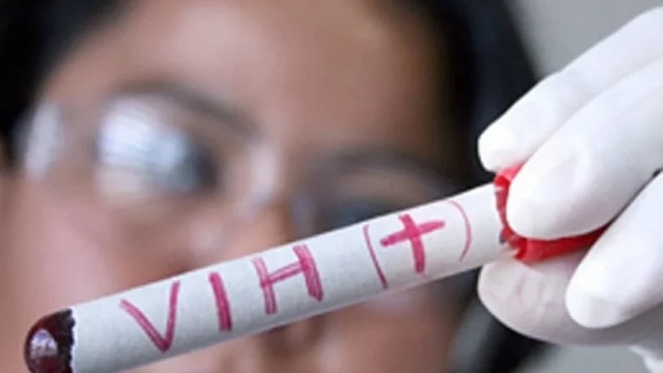 hiv-aids-2318