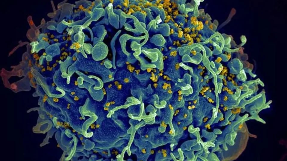 hiv-infecting-a-human-cell-20683459455--960x540