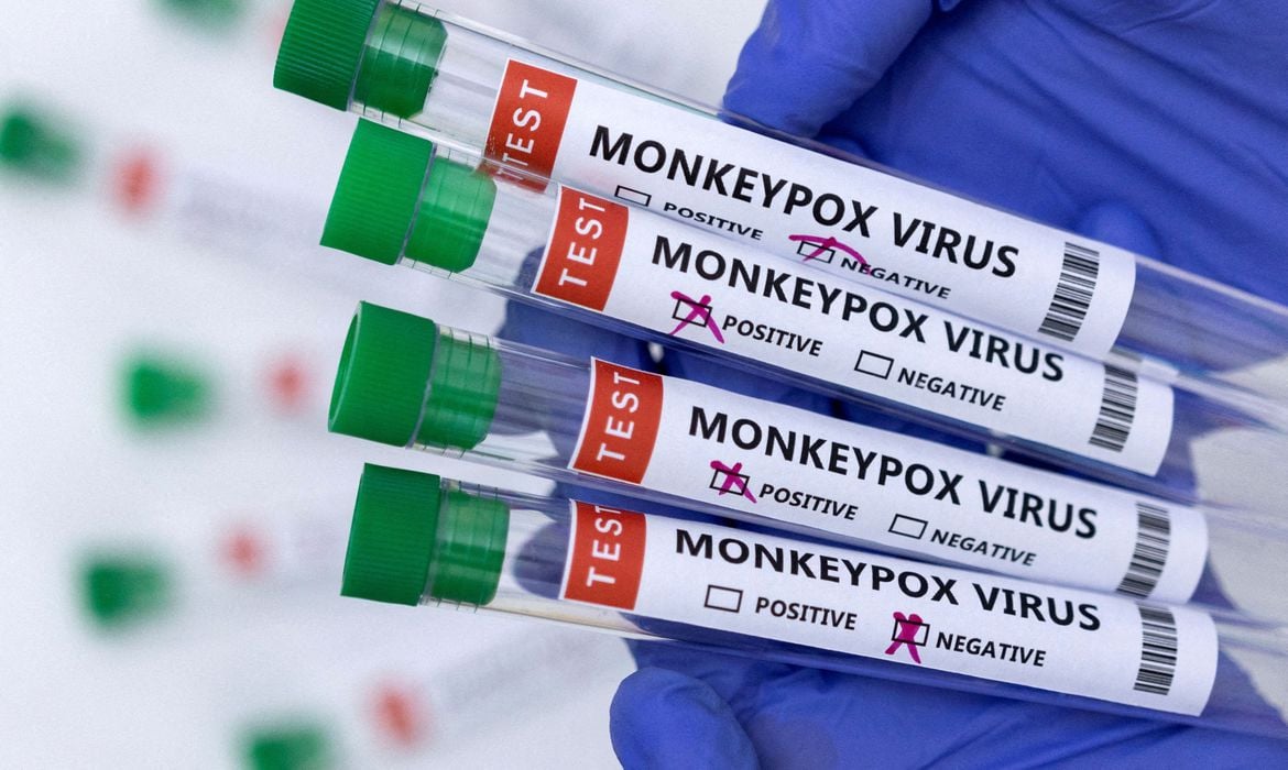 2022-06-03t180308z_672422886_rc25du9i2yos_rtrmadp_3_health-monkeypox-usa