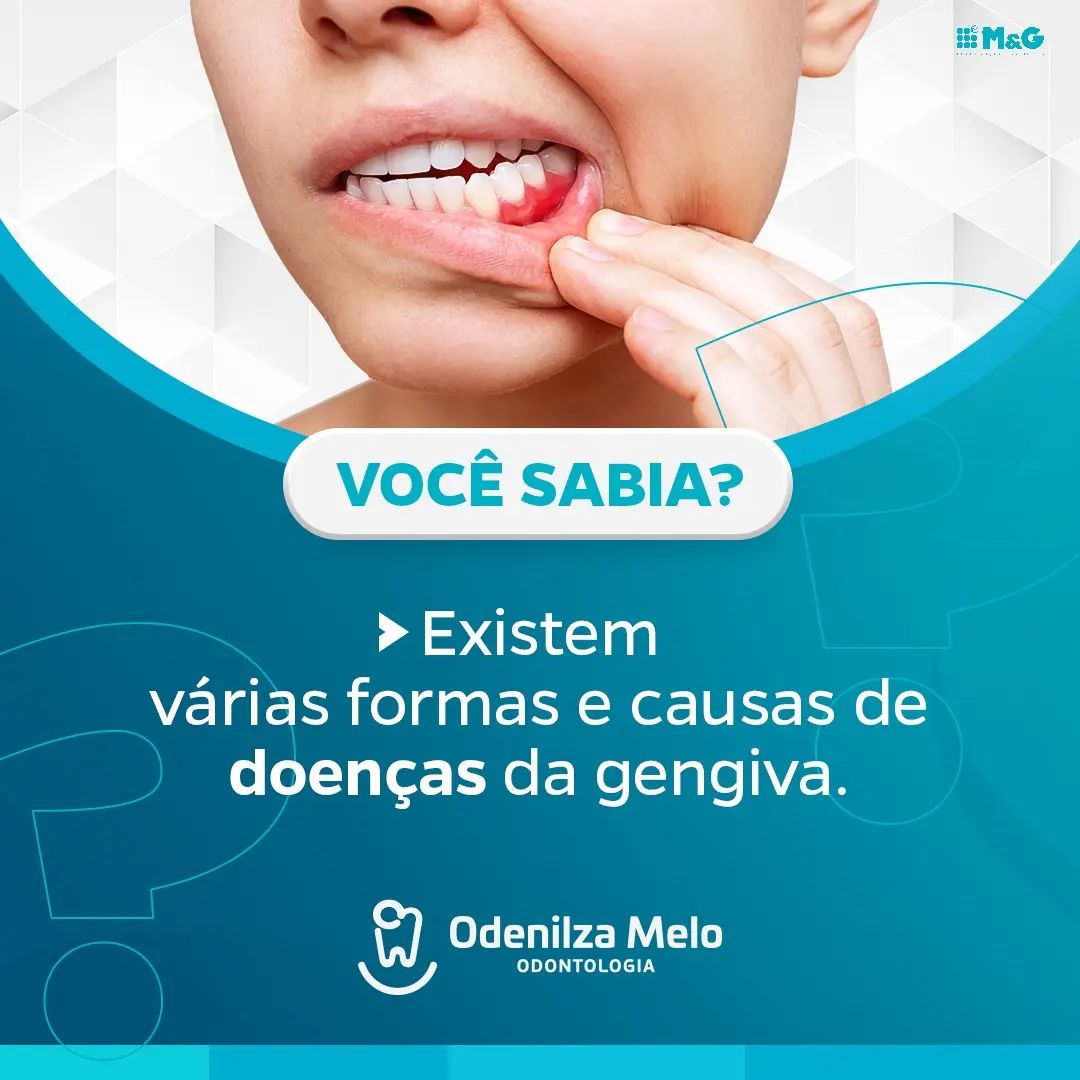 Odenilza301222