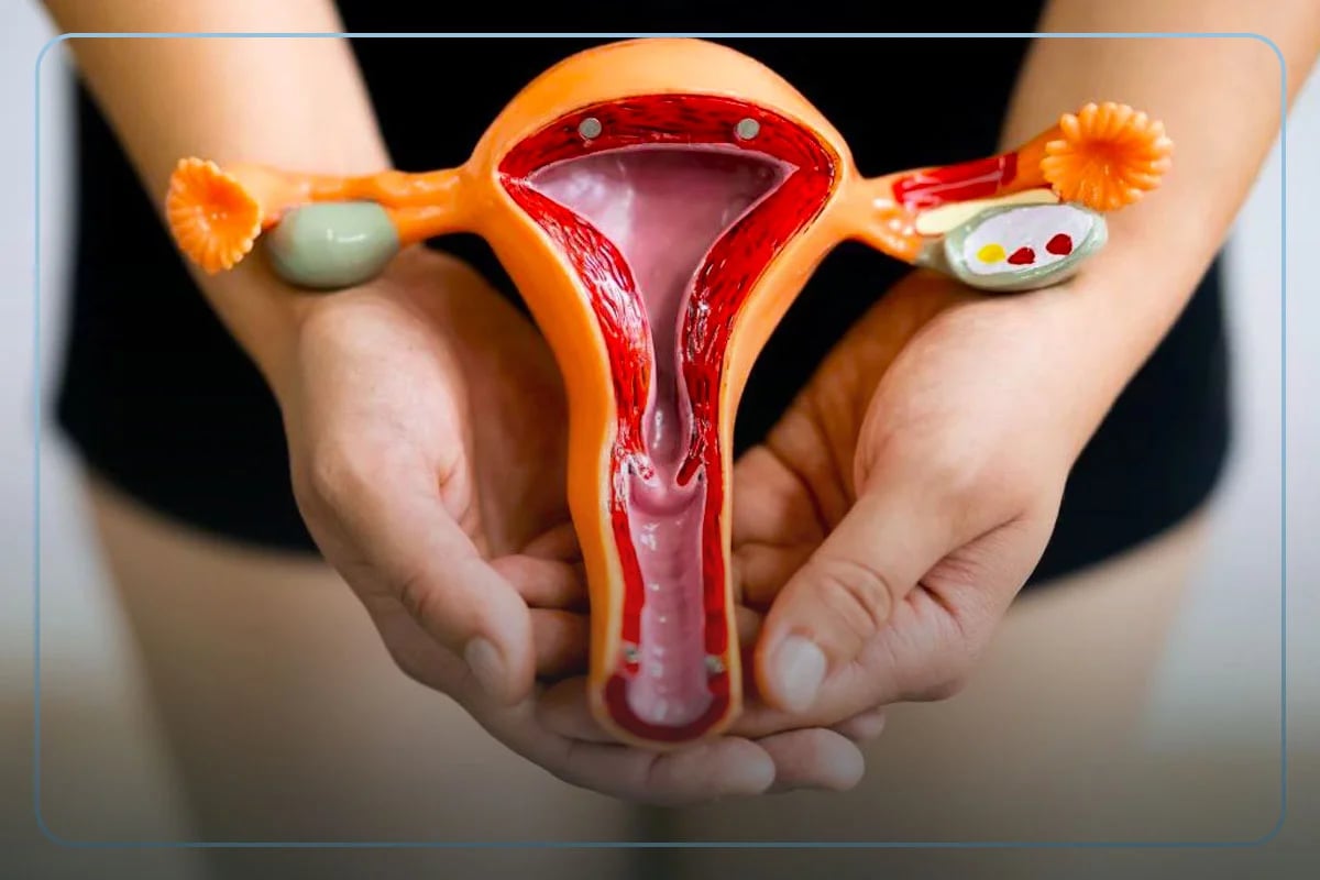 Endometriose-profunda