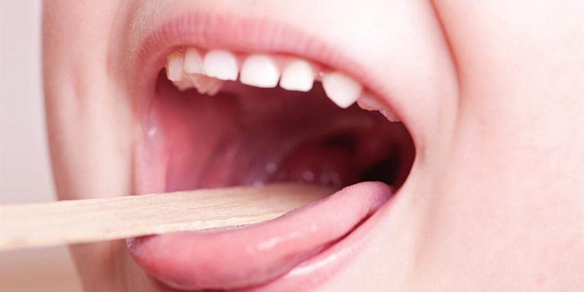 sore_throat_tonsillitis-1140x570