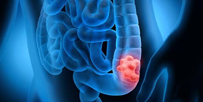 intestino-643585
