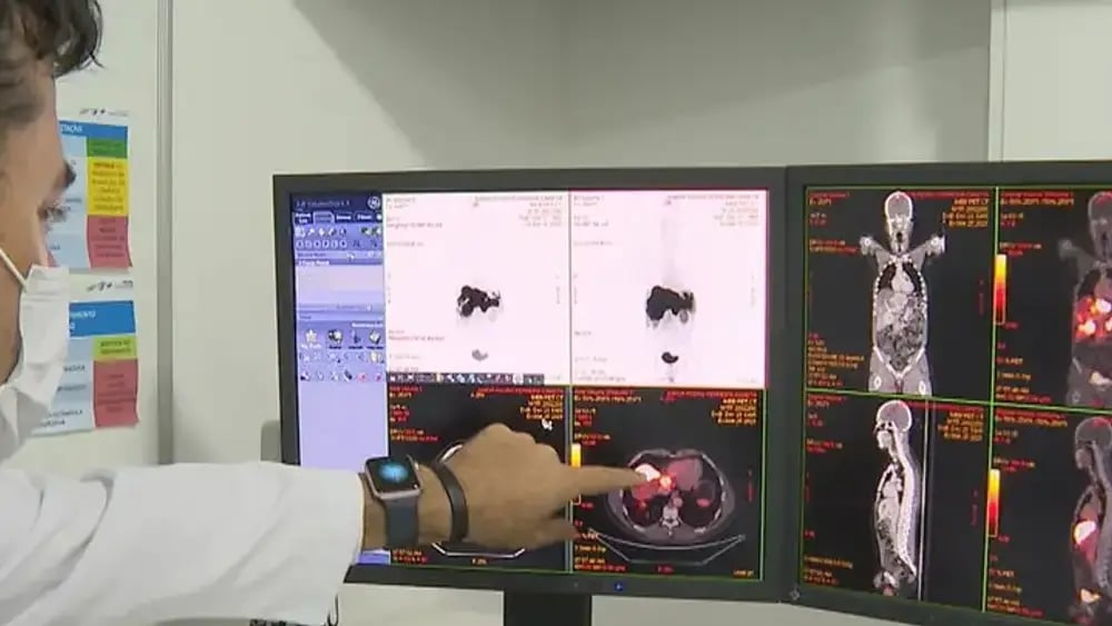 -o-brasil-tera-mais-de-700-mil-novos-casos-da-doenca-a-cada-ano-ate-2025-dad3c607-4cee-4a68-a891-c39f3b5e1b62.large