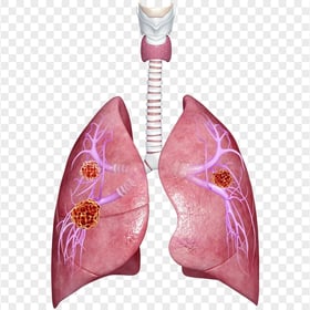 Lungs Lung Bronchus Bacteria Germs Illustration