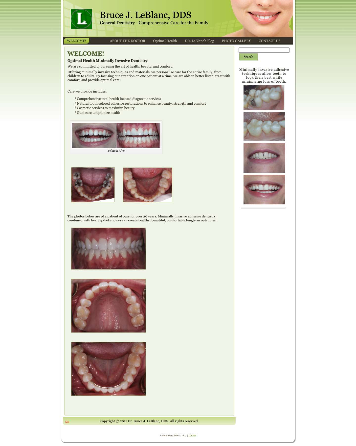 Bruce J. LeBlanc, DDS - Full Screenshot