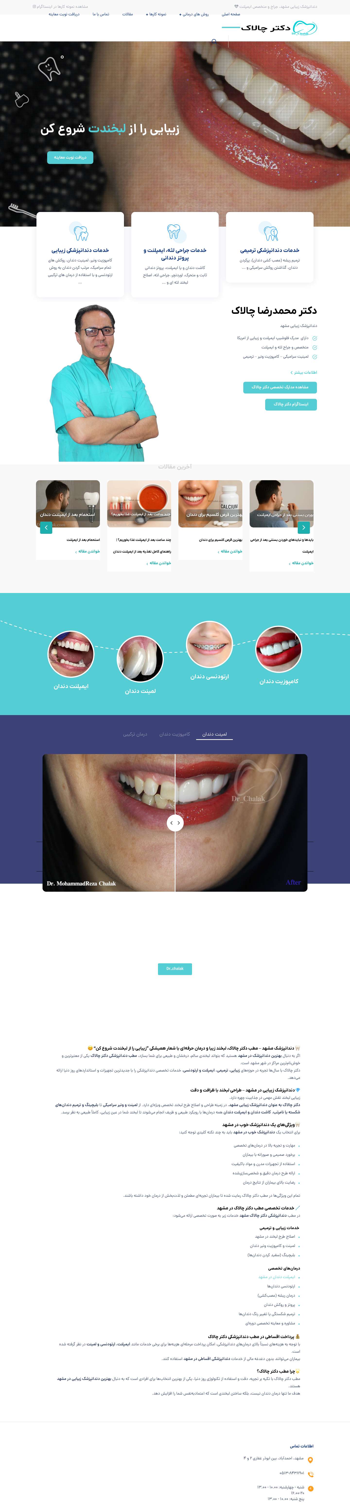 دندانپزشک مشهد | دندانپزشک زیبایی مشهد متخصص ایمپلنت مشهد دکتر چالاک - Full Screenshot