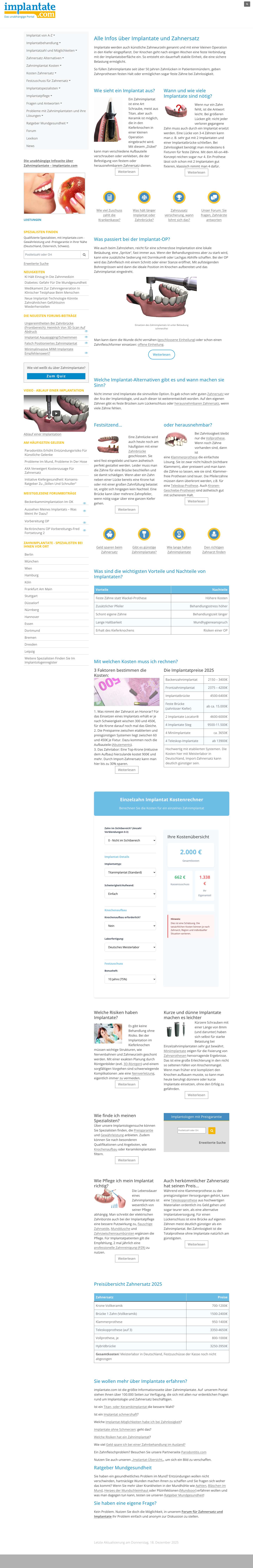 Die unabhängige Infoseite über Zahnimplantate-implantate.com - Full Screenshot