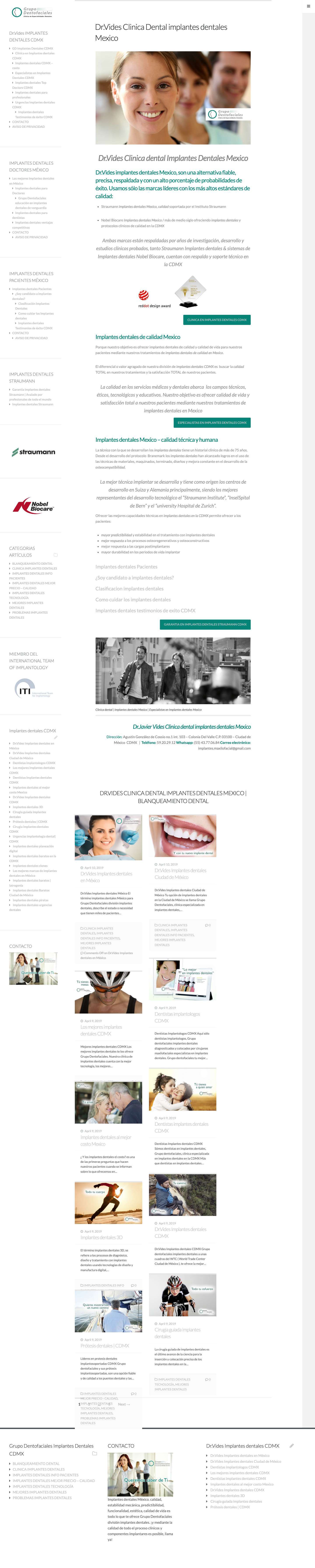 Dr.Vides Clinica Dental Implantes dentales Mexico | Blanqueamiento dental - Full Screenshot