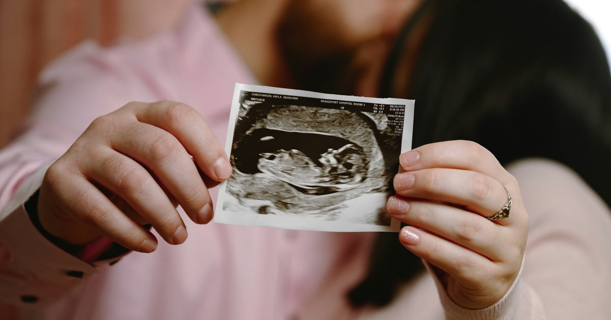 Couple holding ultrasound picture of their baby