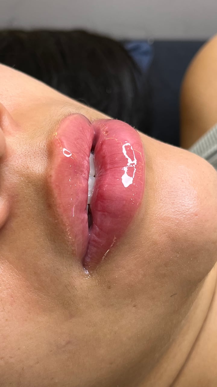 Hydra Gloss
