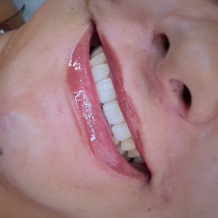 Spa Labial