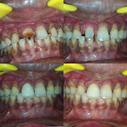 Rajesh Dental Clinic Trichy - 3