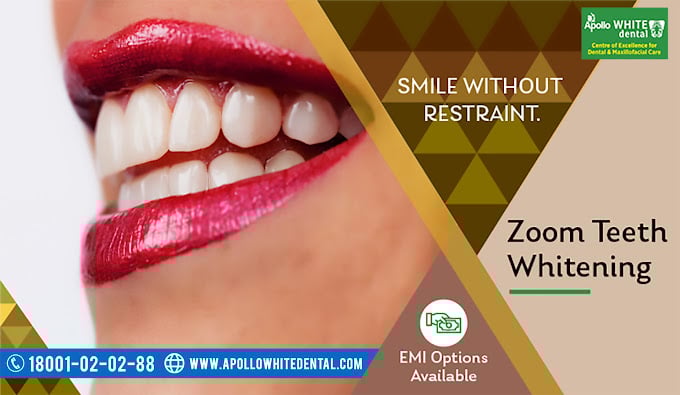 Apollo Dental Clinic - 4