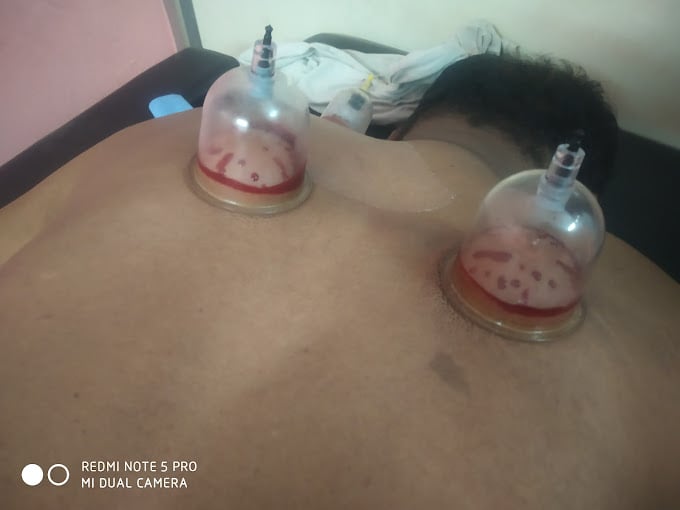 AR-RAHMAN HIJAMA ,ACCU ,AND VARMA POINT - 4