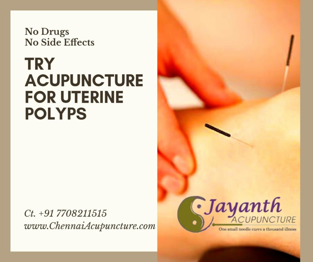 Jayanth Acupuncture Clinic - Anna Nagar - 5