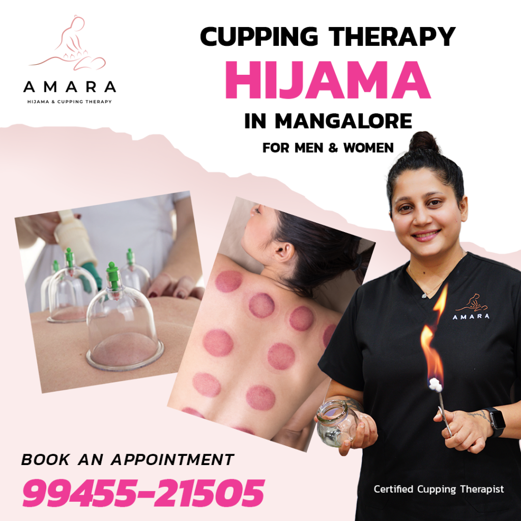 Amara Hijama / Cupping Therapy Mangalore - 3