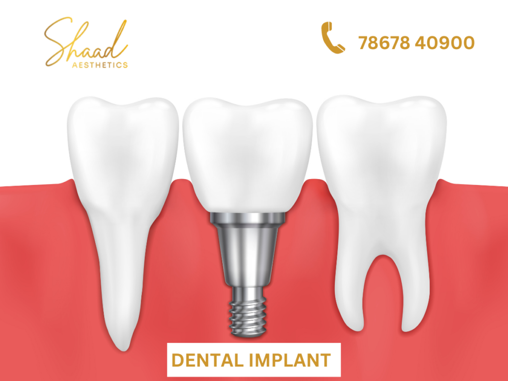 Shaad Aesthetics cosmetic dental clinic in Coimbatore - 4