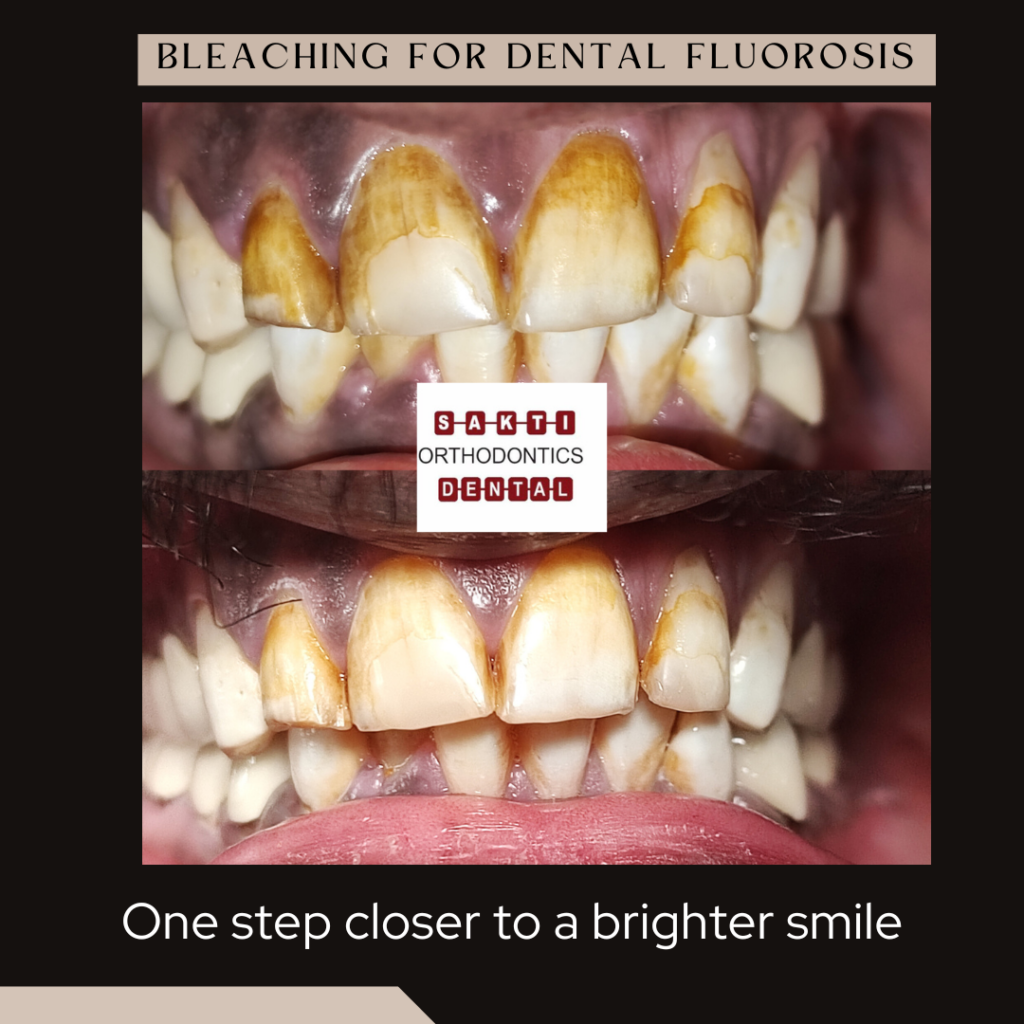 Best Dental Clinic in Tirunelveli | Sakti Dental & Orthodontic Clinic - 4