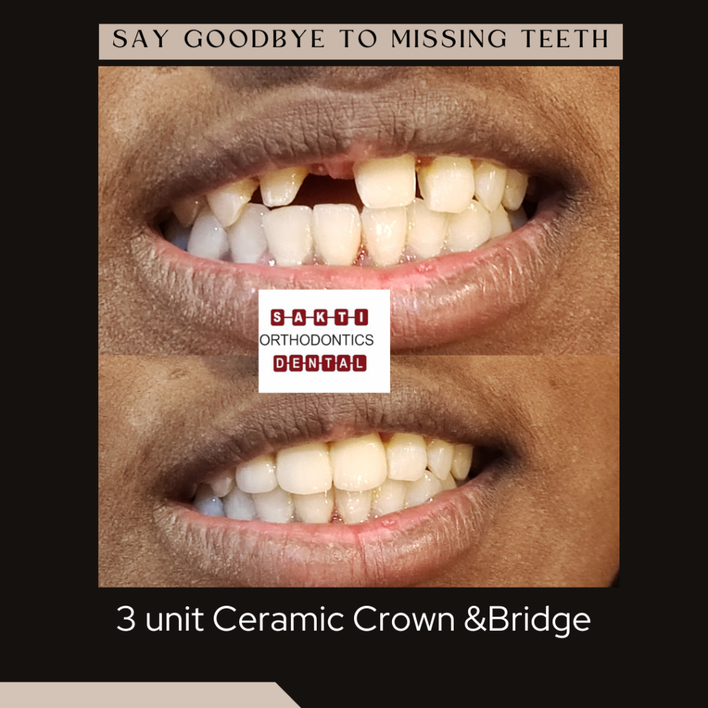 Best Dental Clinic in Tirunelveli | Sakti Dental & Orthodontic Clinic - 5