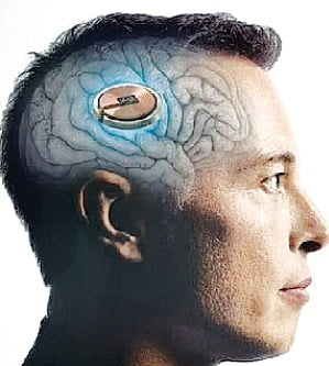 Teknolojia ya Akili Bandia Yaanza Kuwa Kweli: Mgonjwa wa Kupooza Aweza Kuendesha Kompyuta kwa Mawazo Baada ya Kupandikizwa Chip ya Musk