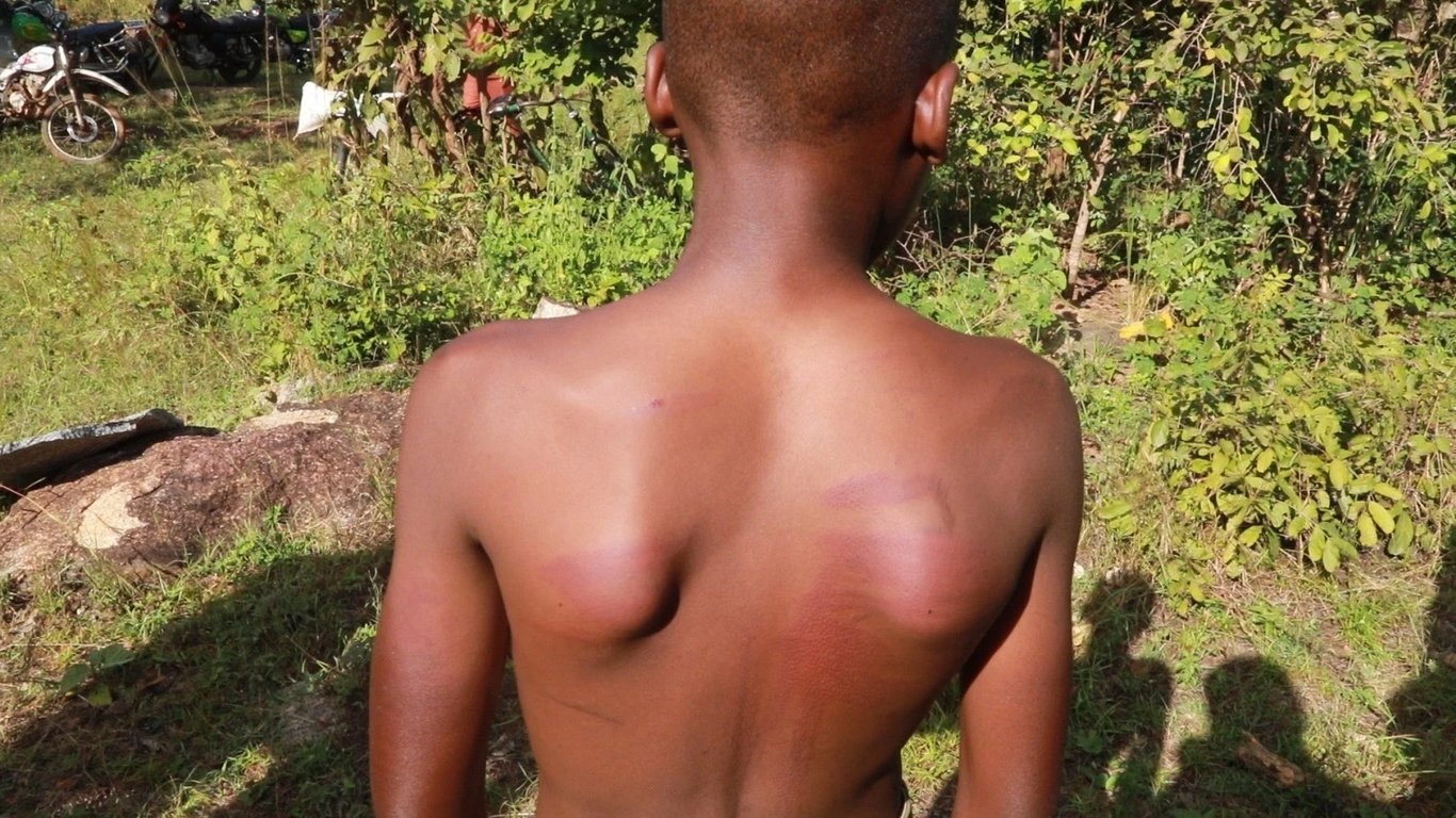 Mwalimu Mkuu Akamatwa Shinyanga kwa Kumshushia Kipigo Kingi Mwanafunzi wa Darasa la Saba