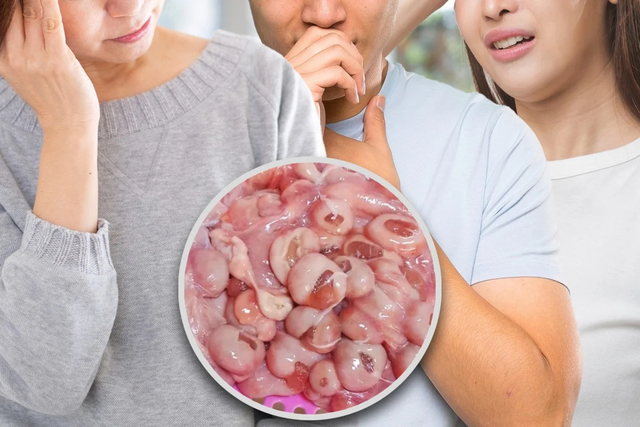 Hatari ya Kula Kifuko cha Mimba (Plasenta) ya Kondoo: Familia Yaangukia Hospitalini China