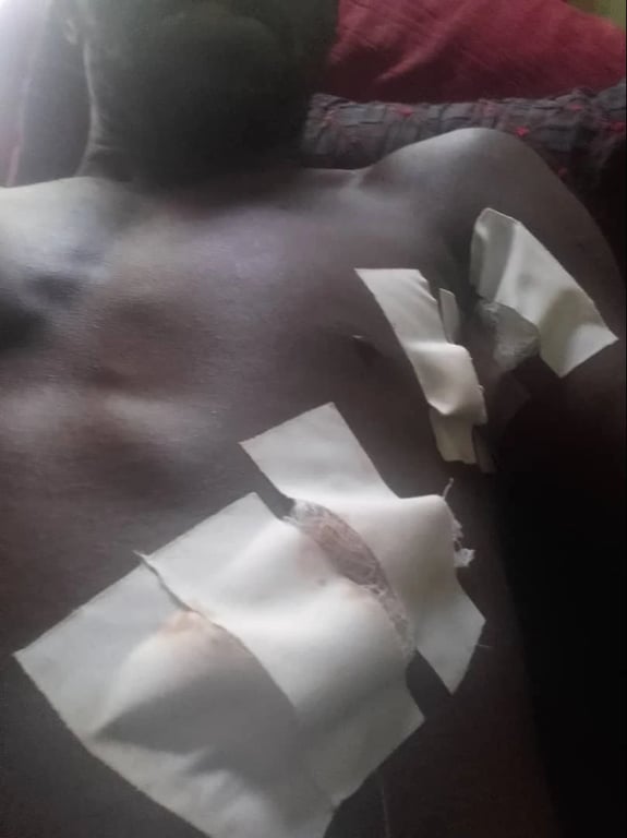 Maumivu Baada ya Uchaguzi: Mkazi wa Gongo la Mboto Apigania Uhai, Aililia Jamii Imokoe
