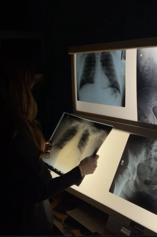 A student holds a chest radiograph up to a two-tier light box displaying additional X-ray images.