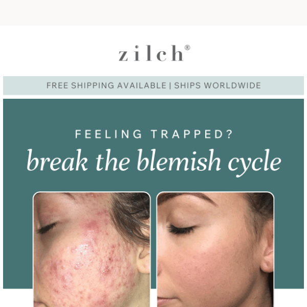 Zilch Acne, you deserve this 👉