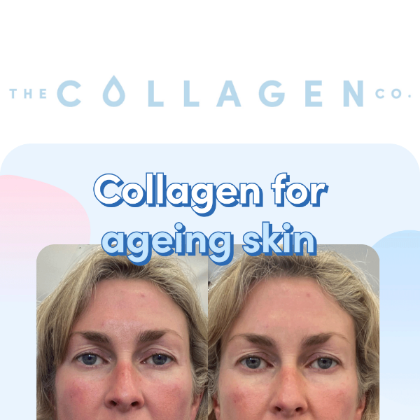 Transform Your Skin in 7 Days with Collagen Co. Products! 🍓🍉