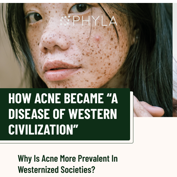 Why is acne more prevalent in Westernized societies?