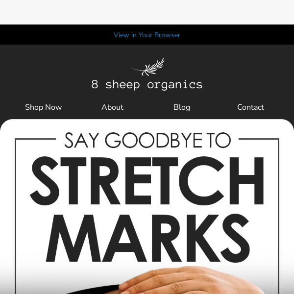 Say Goodbye to Stretch Marks