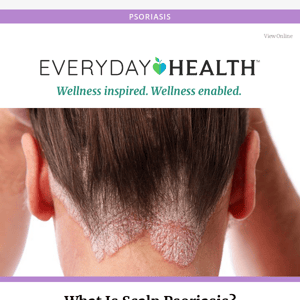 What Is Scalp Psoriasis?