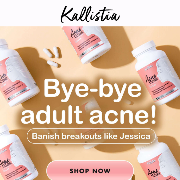 Bye-bye adult acne!