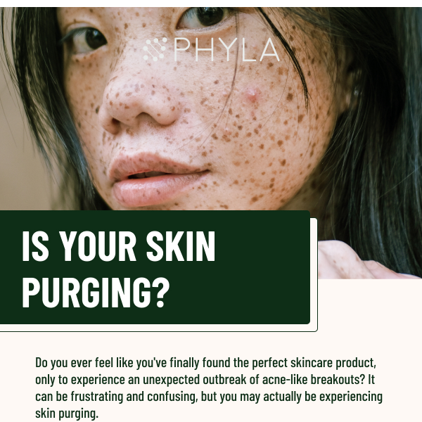 The difference between acne & skin purging