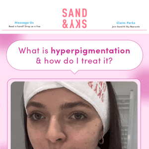 TOP 3 Ingredients to help fight hyperpigmentation!