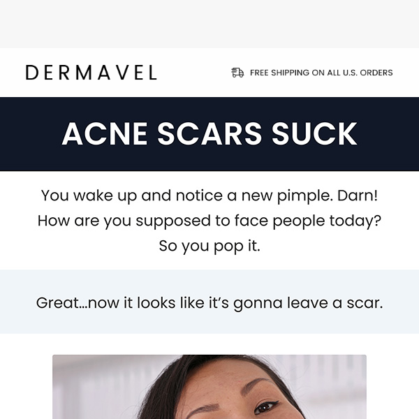 The painful truth about acne scars