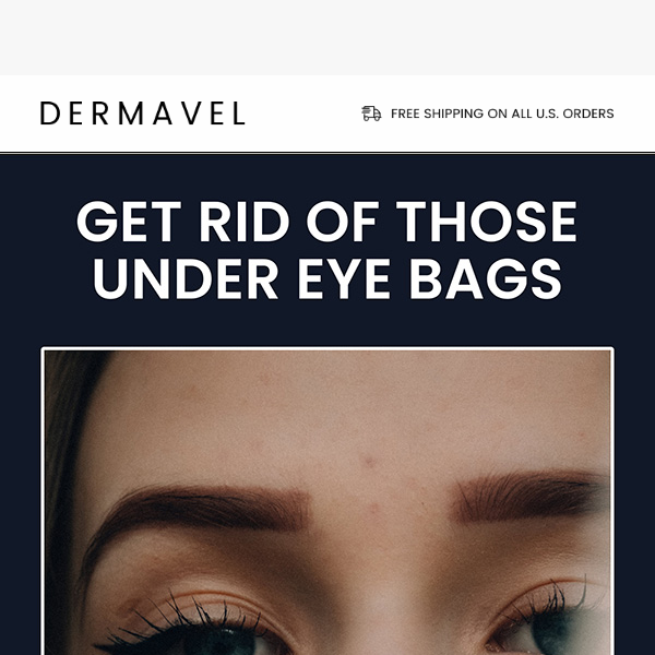 Fix Those Under Eye Bags Now